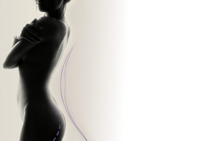 body-2