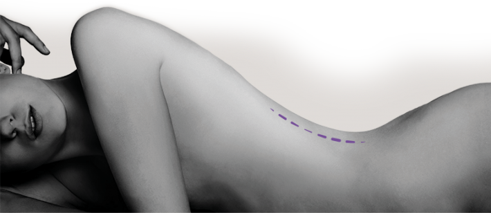 body
