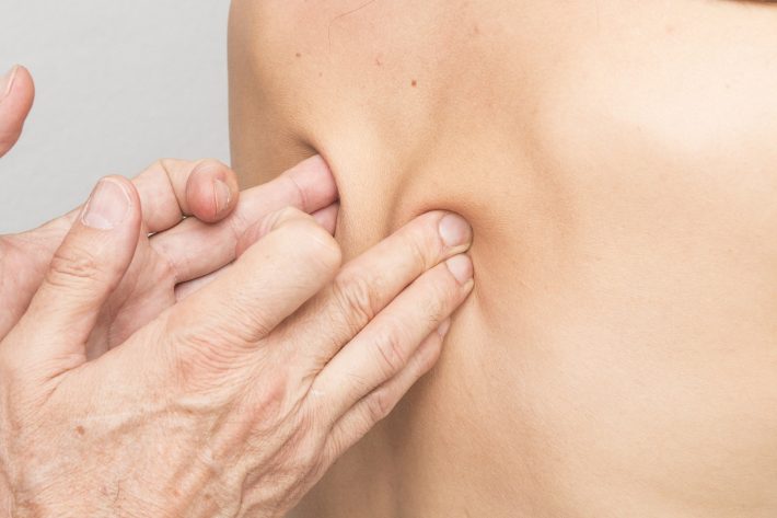 terapia