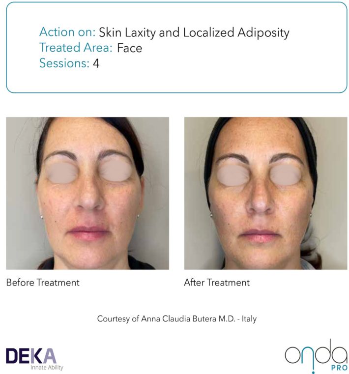 B&A Collection_Onda PRO Rev 1.0-15(1)