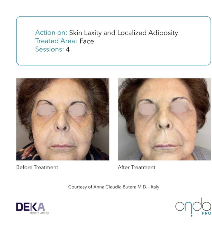 B&A Collection_Onda PRO Rev 1.0-3