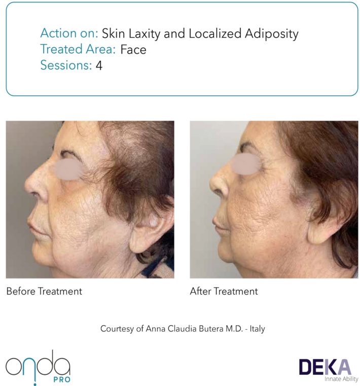 B&A Collection_Onda PRO Rev 1.0-4(1)