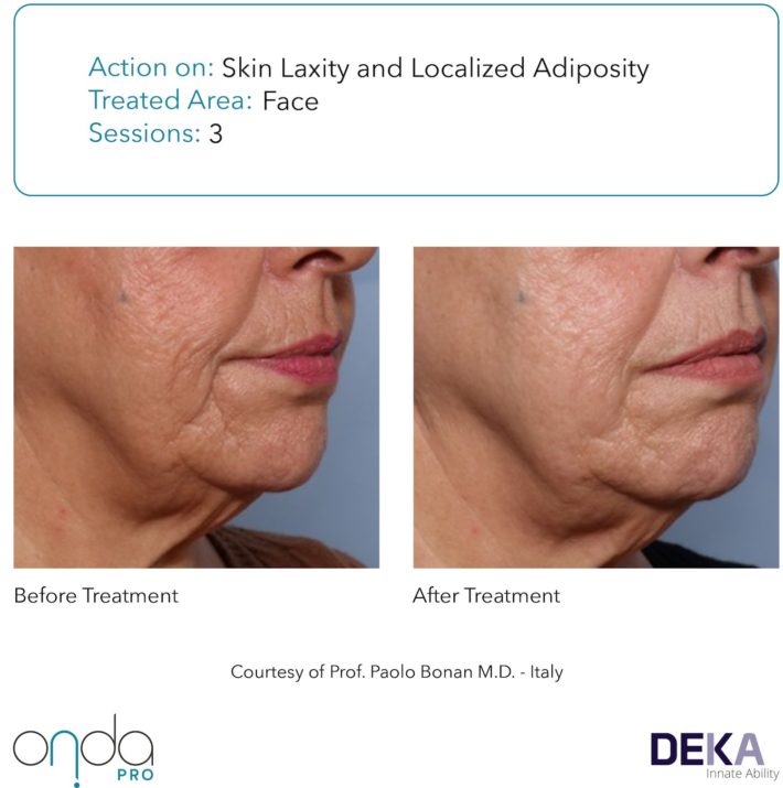B&A Collection_Onda PRO Rev 1.0-48(1)