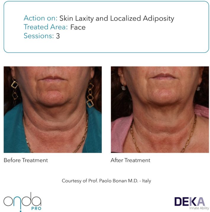 B&A Collection_Onda PRO Rev 1.0-58(1)